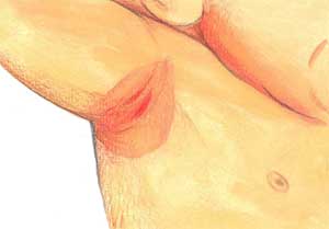 Chafing Picture