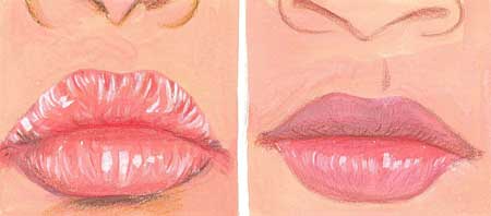 Remedies for Chapped, Cracked, Dry Lips, Treatment, Cure Cracked Chapped and Dry Lips Picture