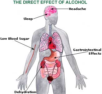 Hangover Home Remedies, Cures, Relief Hangover Picture