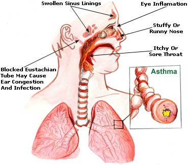 Hay Fever Picture