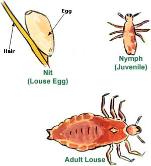 Lice Treatment Picture
