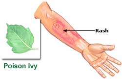 Poison Ivy  Picture
