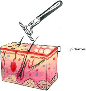 Home Remedies for Razor Burns, Treatment, Relief Razor Burns Picture