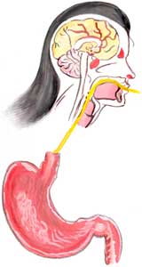 Vomiting Remedies, Causes, Treatment Vomiting Picture