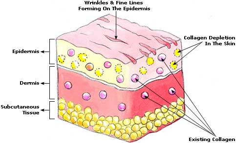 Natural Wrinkles Remedies, Prevent Wrinkles Wrinkles Picture
